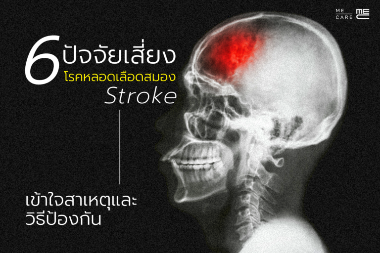 ฮีทสโตรก