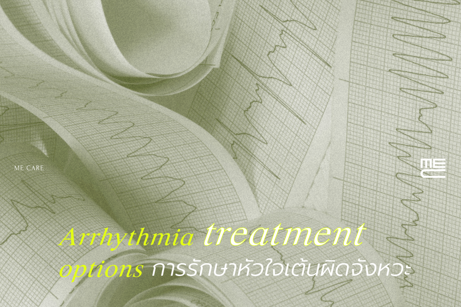 การรักษาหัวใจเต้นผิดจังหวะ (Arrhythmia treatment options) 1 รักษาหัวใจผิดจังหวะ